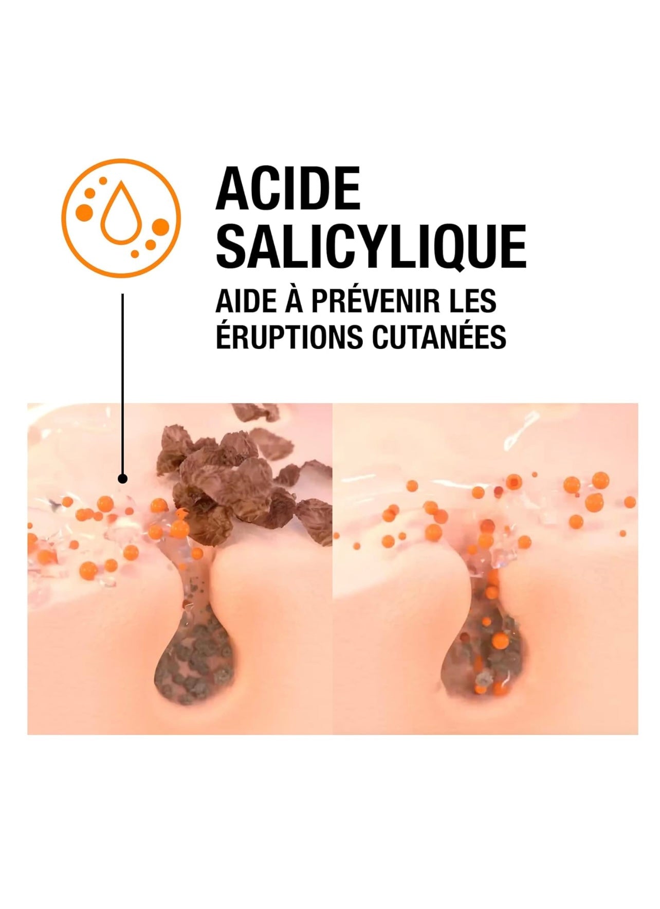 Neutrogena | Gel Nettoyant Anti-Boutons (flacon-pompe de 200 ml) – Nettoyant visage à l'acide salicylique (2%) – Élimine l'excès de sébum et les impuretés pour une peau plus nette en seulement 1 jour*